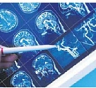 שינוי התוויות טיפול באפילפסיה ובטרשת נפוצה
